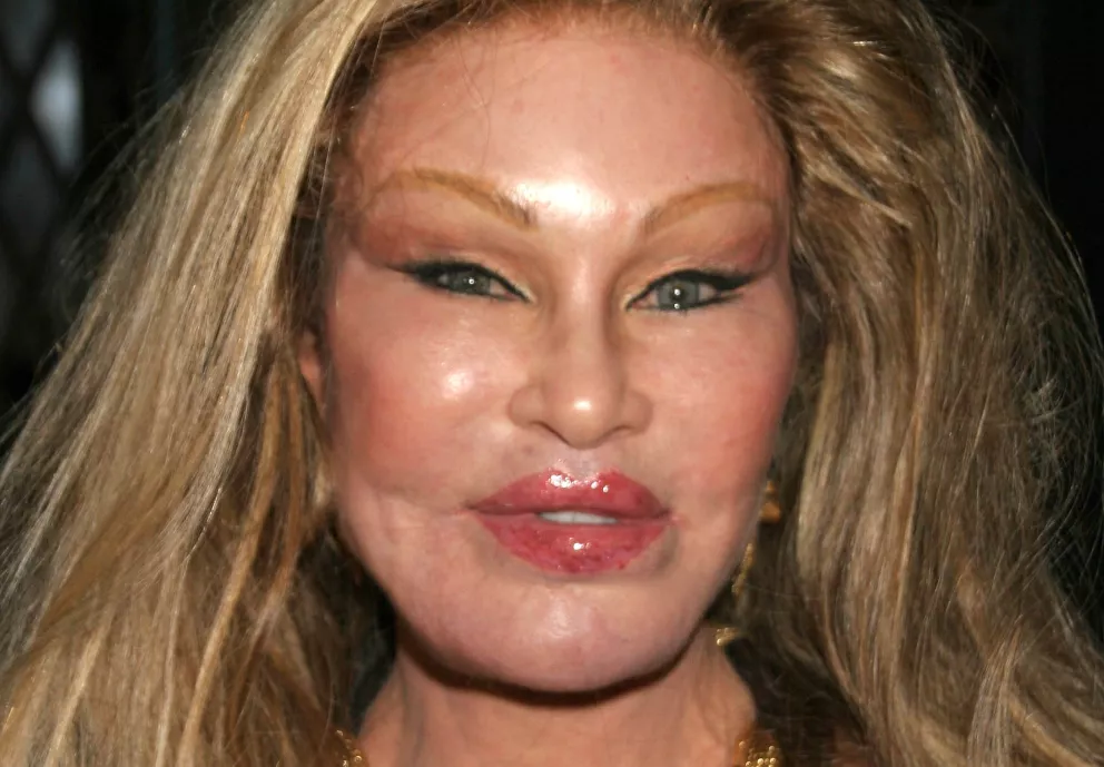 Jocelyn Wildenstein