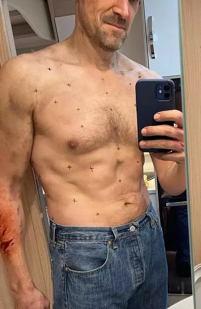 Foto 5 k článku Hvězda seriálu Stranger Things, David Harbour, zhubl 34 kilo. Jeho tělo zažívá pořádné šoky díky váhovým výkyvům