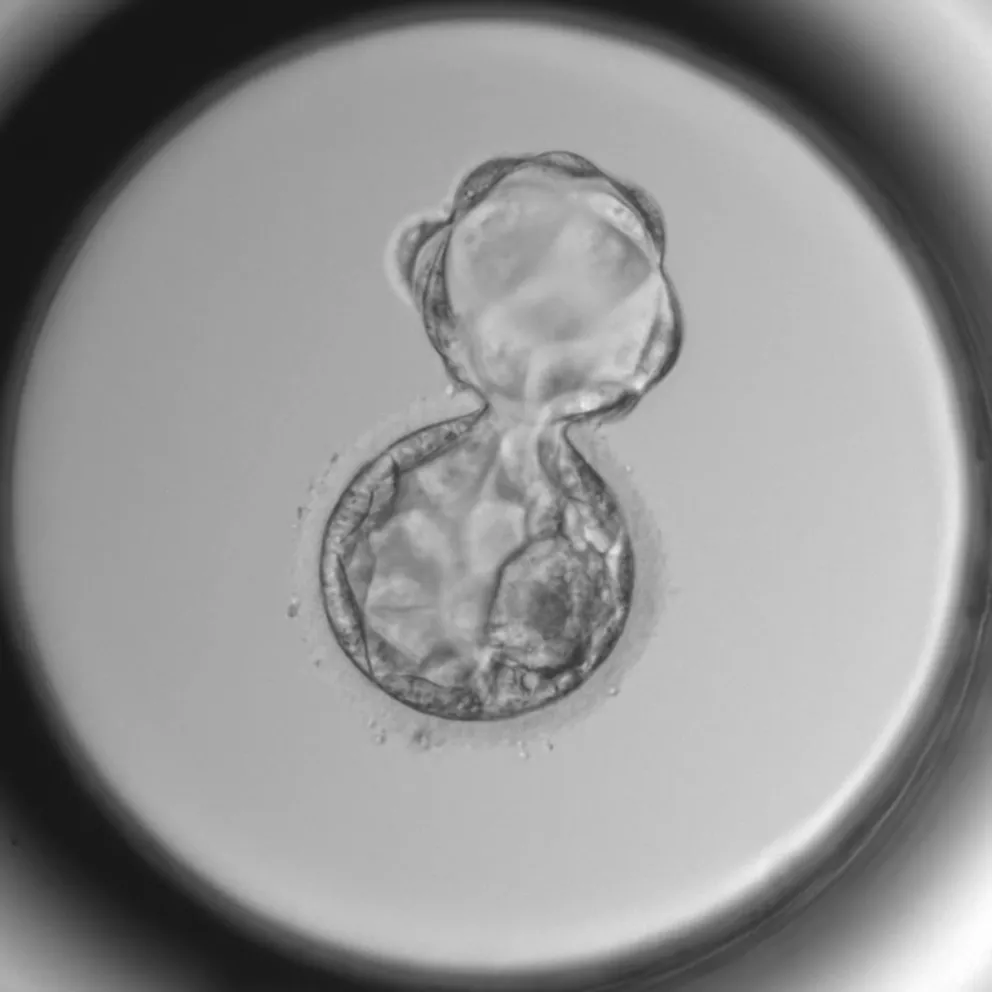 Embryo