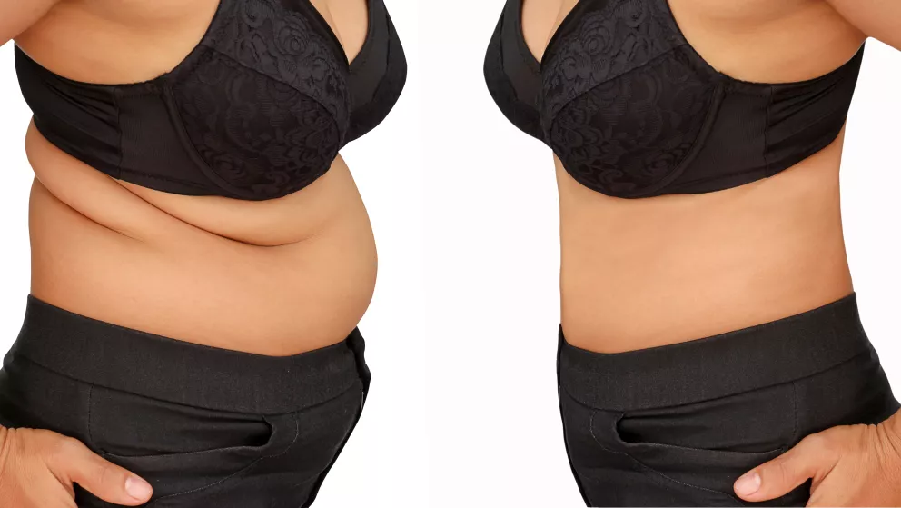 Jak zhubnout břicho za 2 dny