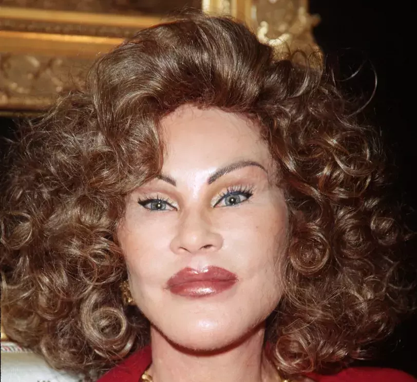 Nepřirozené kočíčí oči Wildenstein