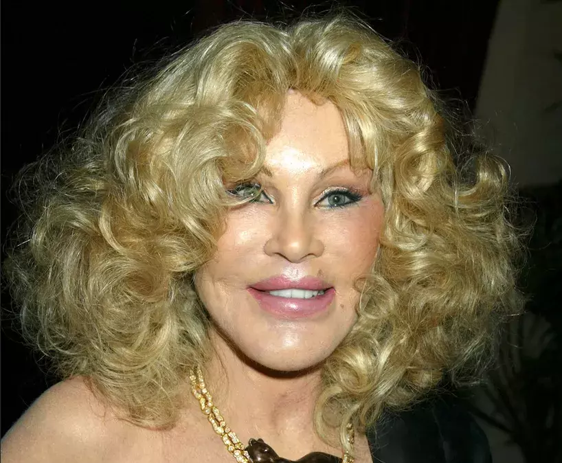 Wildenstein začíná proměnu