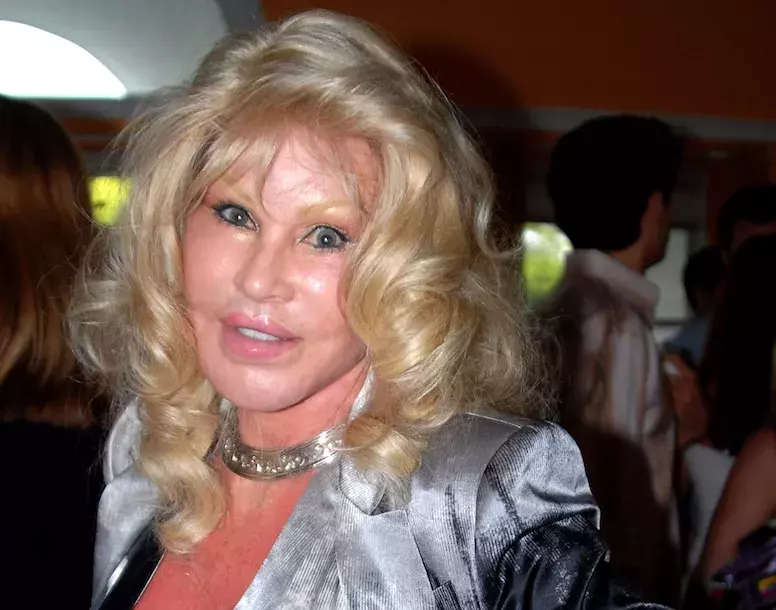 Jocelyn plastikám propadla