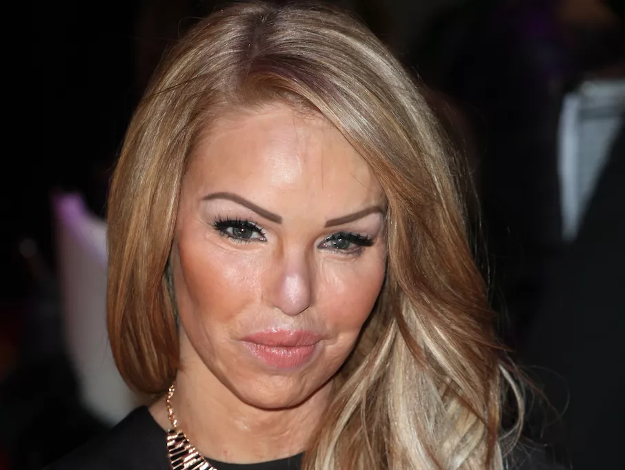 Katie Piper