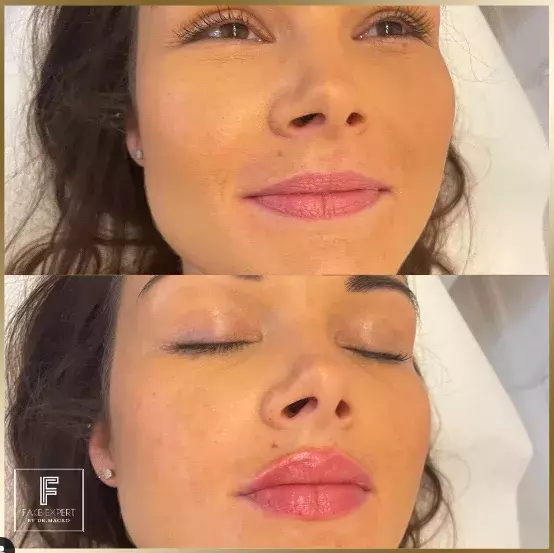 Foto 4 k článku Češky propadly kouzlu zvětšených rtů: Doktorka estetické medicíny, která je jimi proslulá, ovšem nevyhoví každé zákaznici