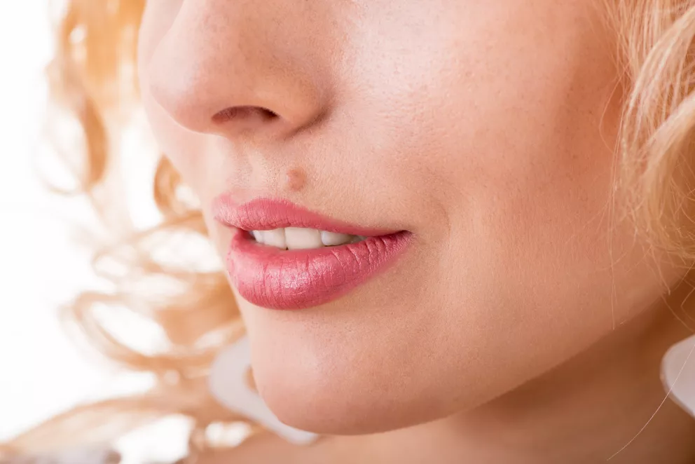 Mateřské znaménko