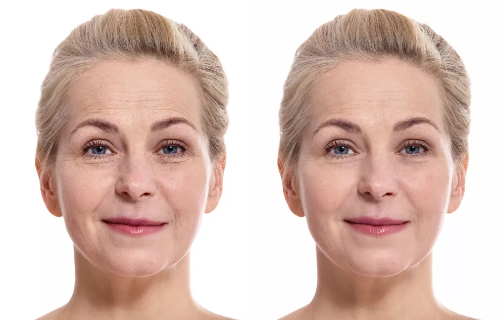 Věci, které urychlují stárnutí