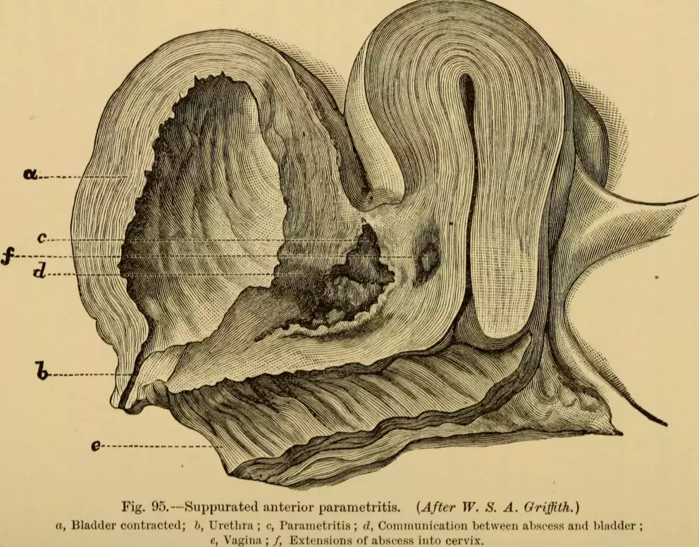 dobový nákres ženských rodidel