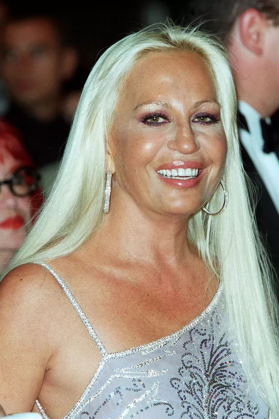 Celebrity a plastiky 