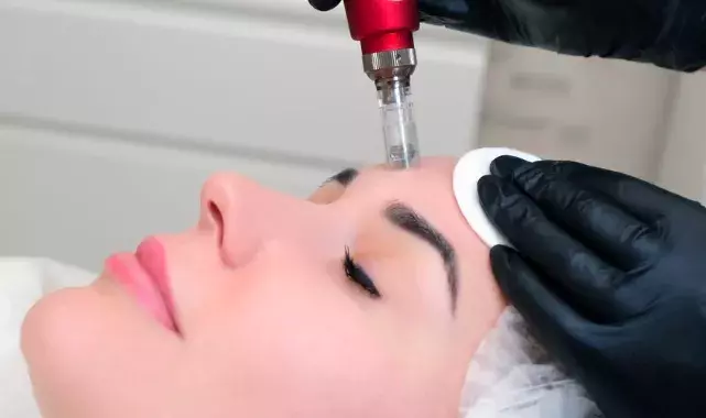 Microneedling, radiofrekvence, kyselina hyaluronová: Které z moderních trendů stojí za vyzkoušení i za investici?