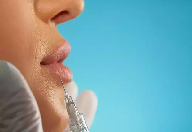 Microneedling, radiofrekvence, kyselina hyaluronová: Které z moderních trendů stojí za vyzkoušení i za investici?
