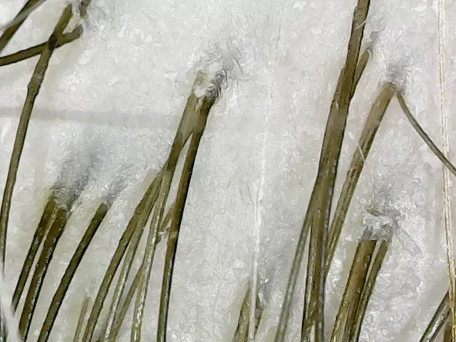 Vlasova pokožka před procedurou