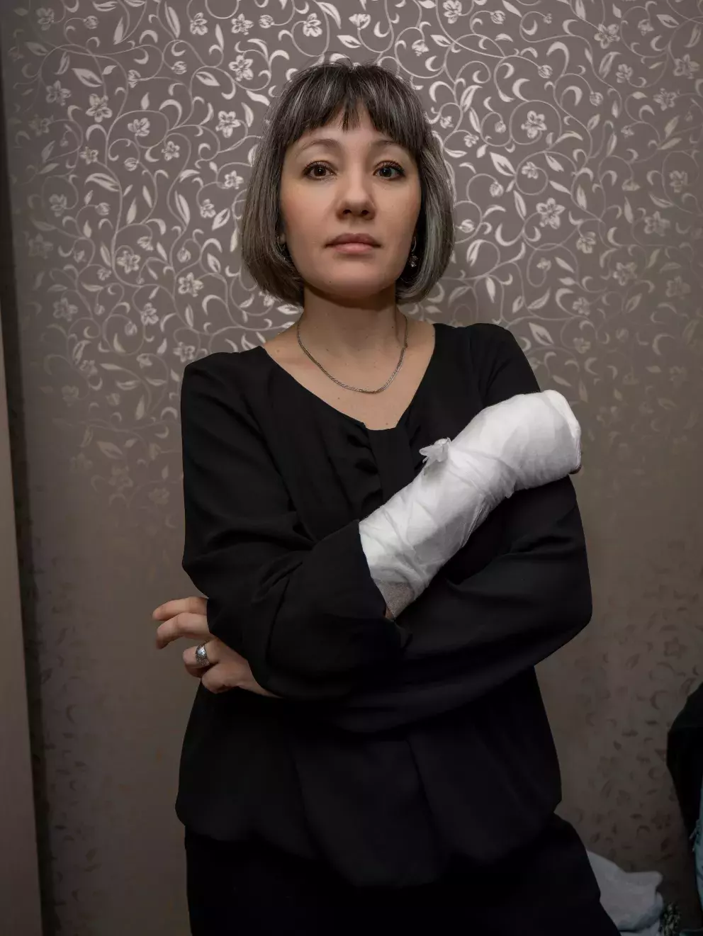 žena, úraz, ruka, problém, manželství, smutek