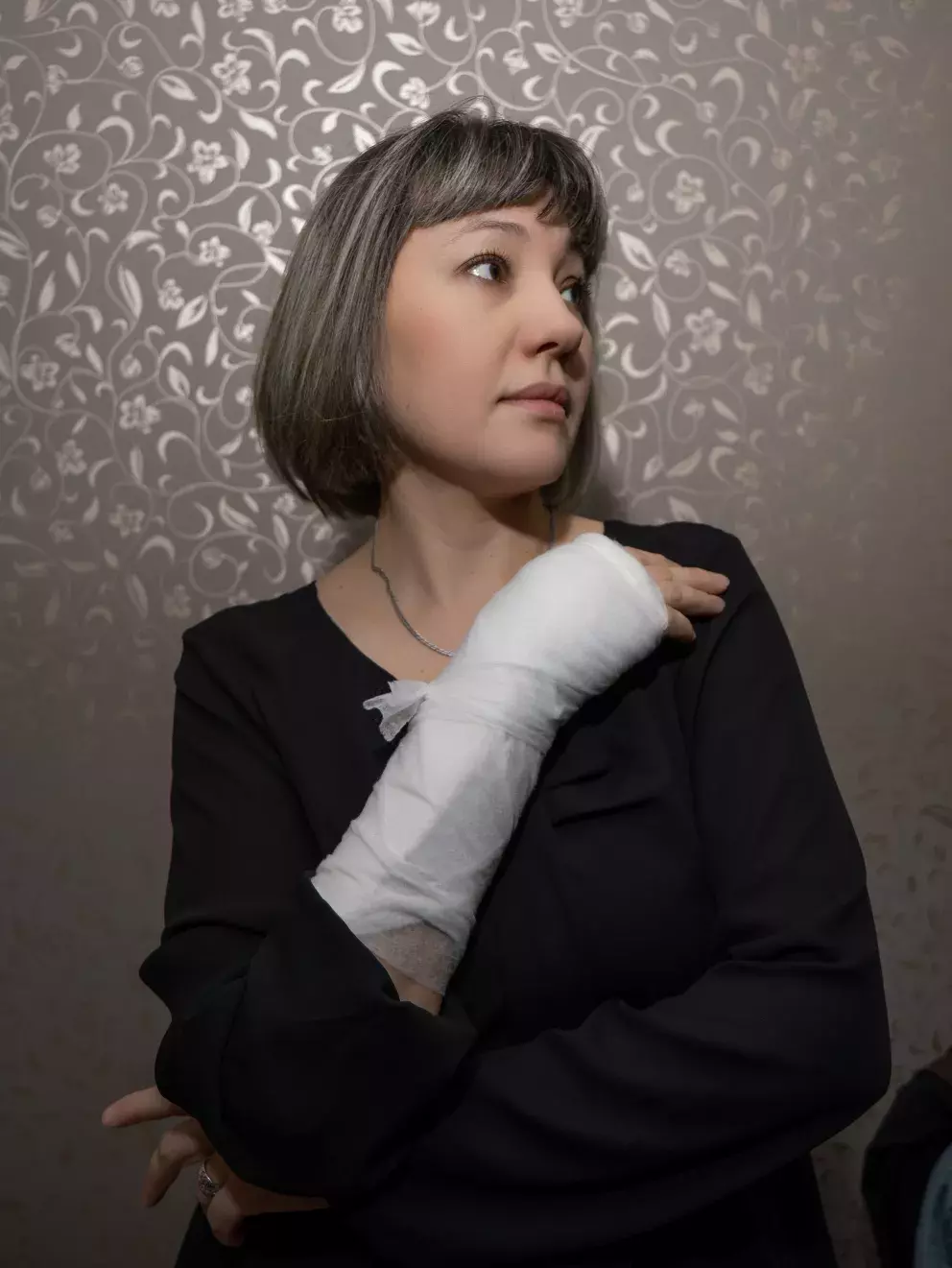 žena, úraz, ruka, problém, manželství, smutek