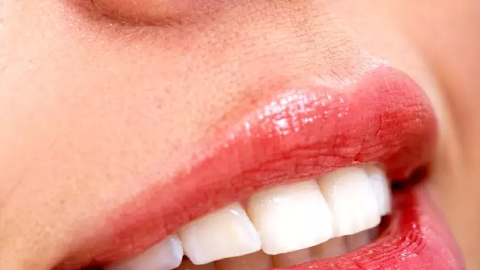 Jak na nové zuby: Možnosti na výběr