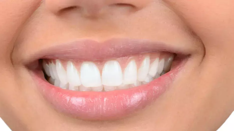 Máte v úsměvu „díry“? Vaši krásu zachrání nové zuby