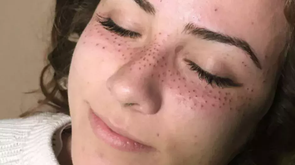 Nový beauty trend? Vytetované pihy!