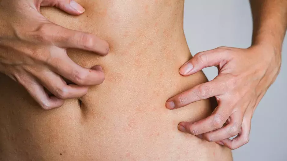 Trápí vás zarudlá a vysušená pokožka? Dopřejte si správnou péči