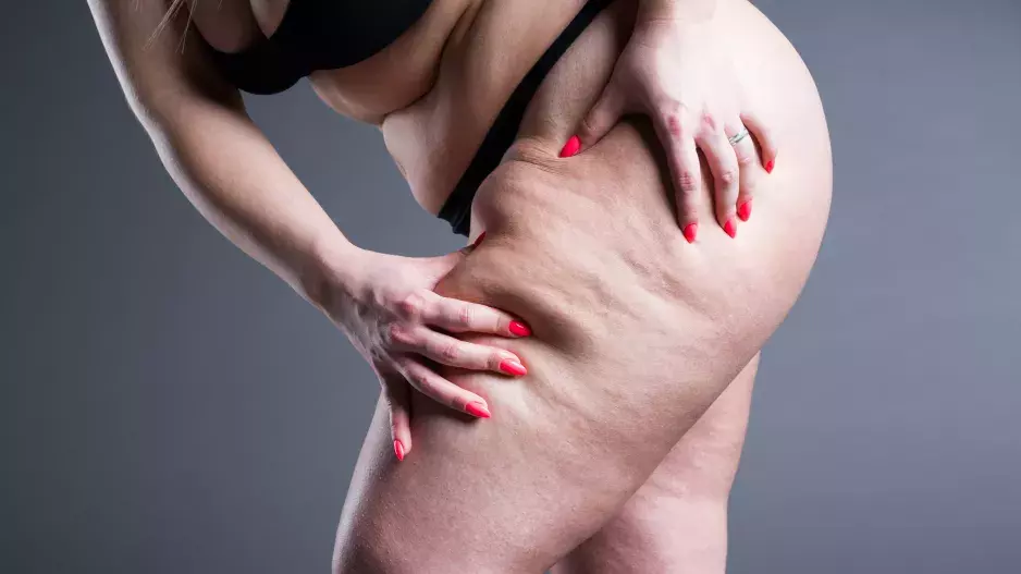 Řadě žen se nedaří zhubnout stehna: Máme pro vás osvědčený návod jak na to, cvičit nestačí!