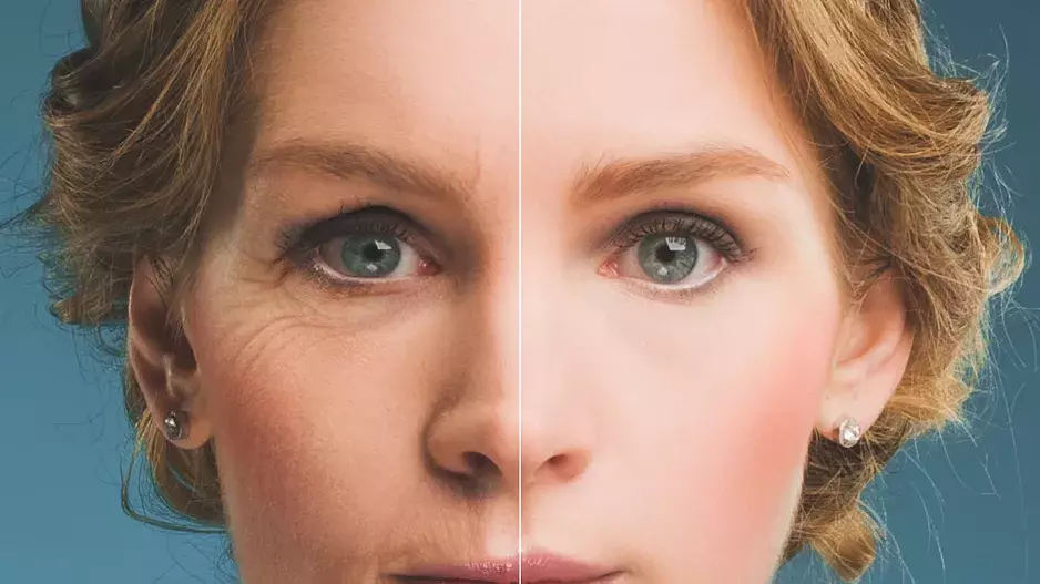 Pokožka poškozená slunečním zářením: Dermatologové radí, jak se zbavit pigmentových skvrn a vrásek