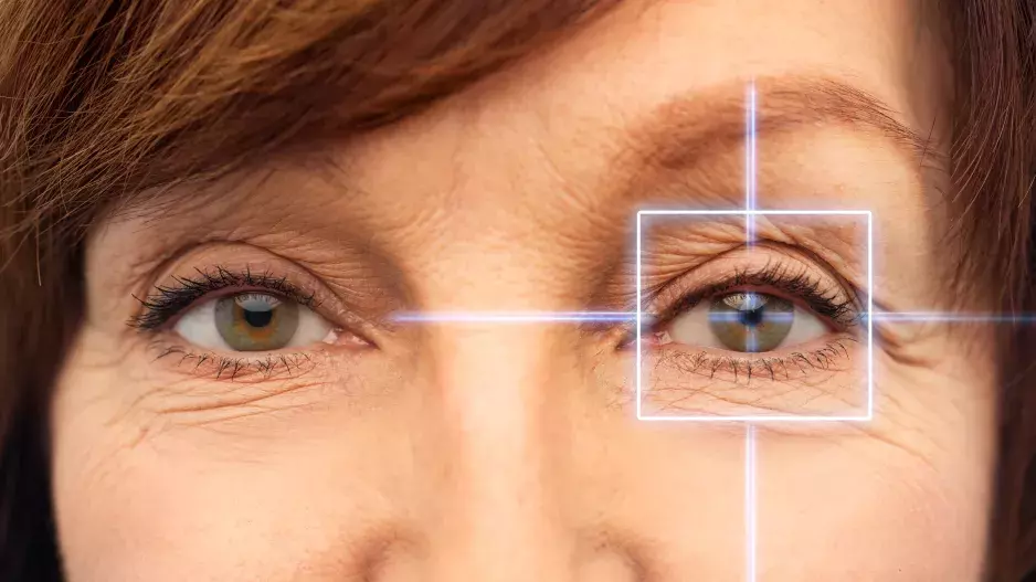 Povislá oční víčka jsou kosmetickým i zdravotním problémem: Omladit jejich vzhled lze i bez plastiky v každém věku a je to skoro zadarmo!