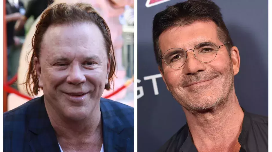 Mužské celebrity, které podstoupily estetické zákroky: Udělaly z nich plastiky větší krasavce nebo voskovou figurínu?