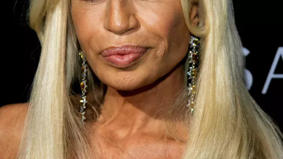 Jak by celebrity vypadaly bez plastik: Grafik si s touto myšlenkou pohrál a změnil slavné k nepoznání