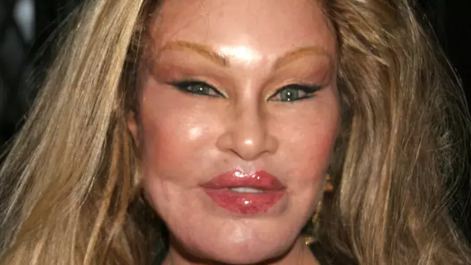 Kočičí žena: Kdysi bývala neskutečně bohatá a krásná. Dnes pobírá sociální dávky a obličej má znetvořený plastikami