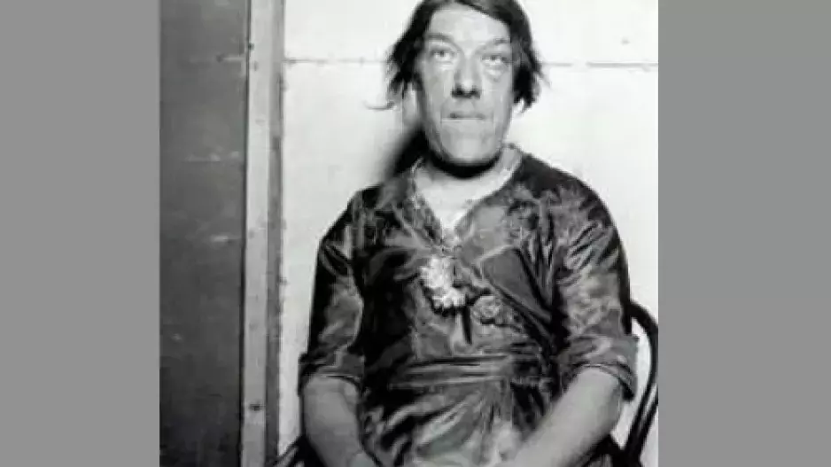 Nejošklivější žena na světě: Nechala se šikanovat proto, aby uživila své děti