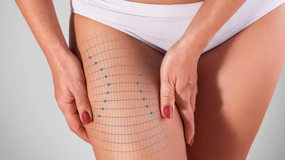 Zpevněte svá stehna díky těmto nejúčinnějším cvikům, které zvládnete i doma: Horolezec, dřep u zdi nebo stání na špičkách