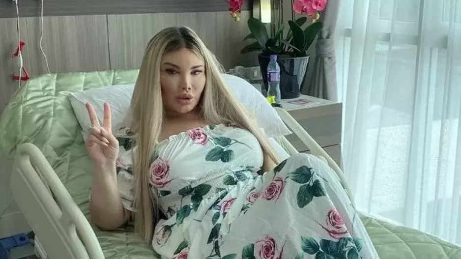 Bývala Ken, nyní je z ní po více než 90 operacích Barbie. Jessica Alves si nechala udělat oči jako Bella Hadid