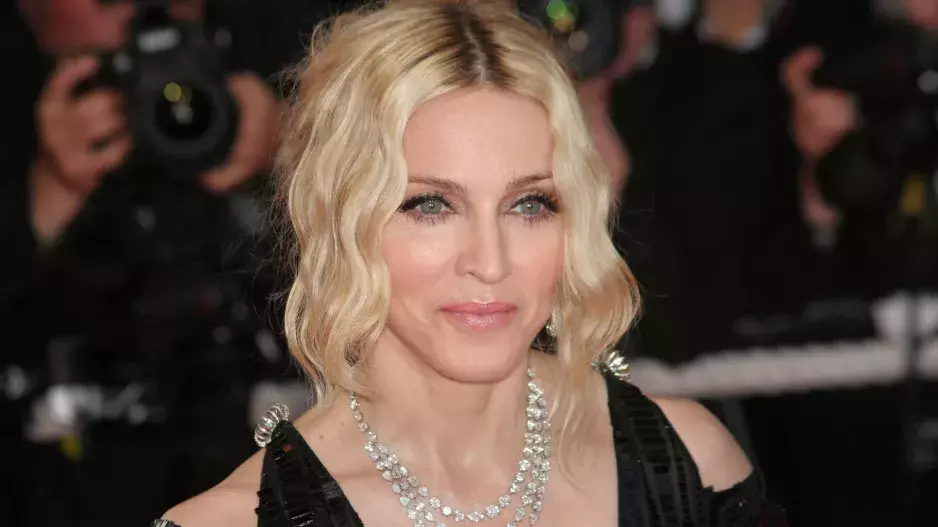 Madonna to s plastikami doslova přehnala: Změnila se k nepoznání, fanoušci prosí, aby toho nechala