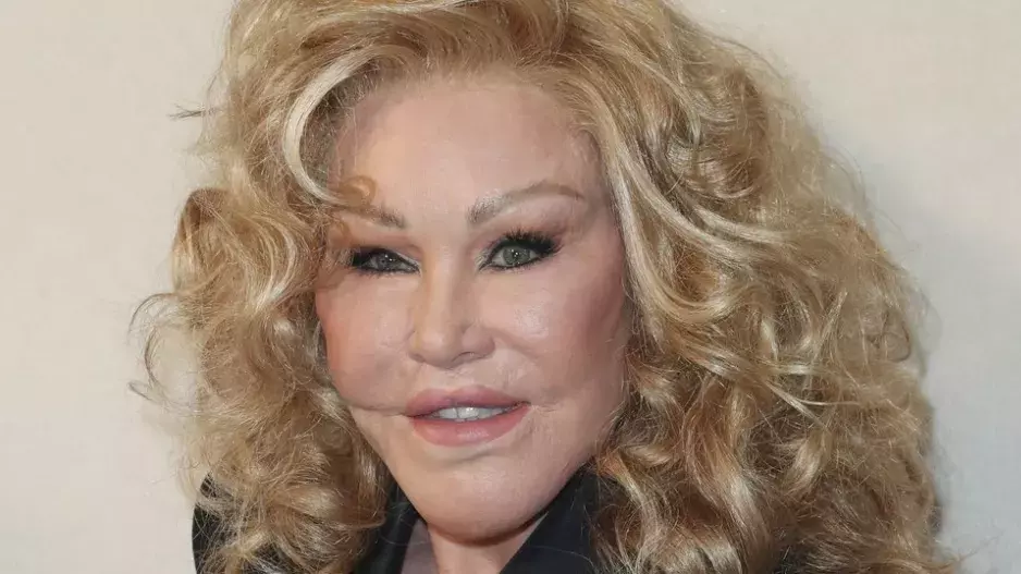 Kočičí žena ukázala novou fotku z mládí, která se ihned stala hitem internetu: Bývala krásnou baletkou, pak ale ztratila soudnost