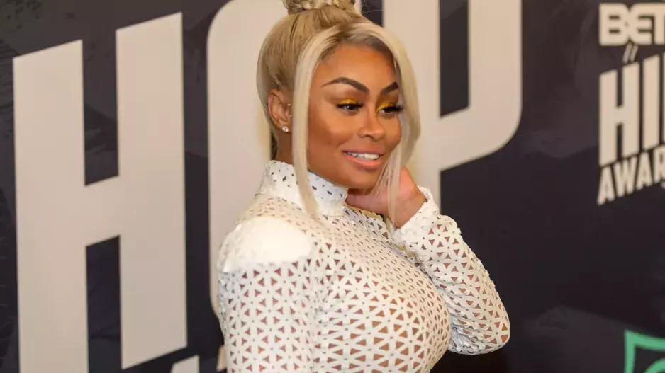 Hollywood se rozpouští: Slavné celebrity litují svých výplní a nechávají si je odstranit