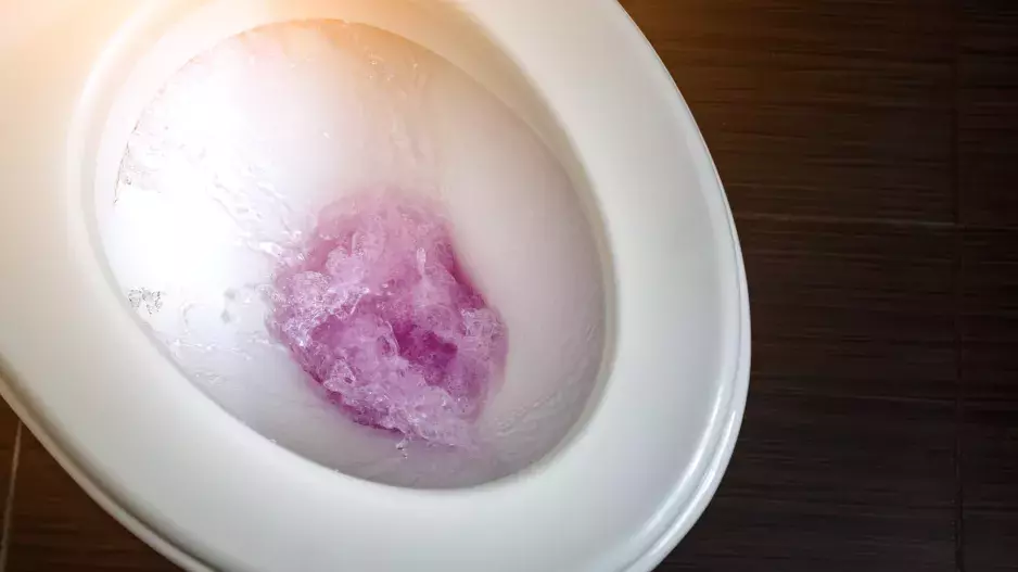 Pozor, zdraví škodlivé: Většina lidí nesprávně splachuje WC a ohrožujete tím zdraví celé rodiny