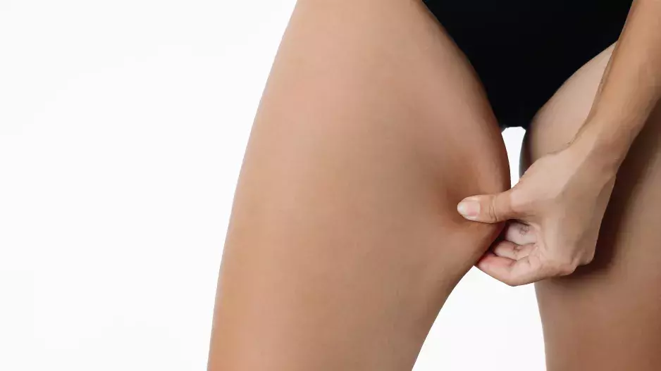 Zastavte nepříjemné odírání stehen díky jednoduchým radám. Správné oblečení není zdaleka všechno