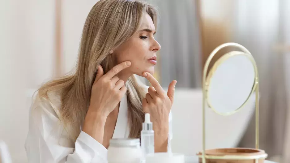 Pupínky po čtyřicítce: Dermatoložka radí, jak se jich zbavit z pohodlí domova