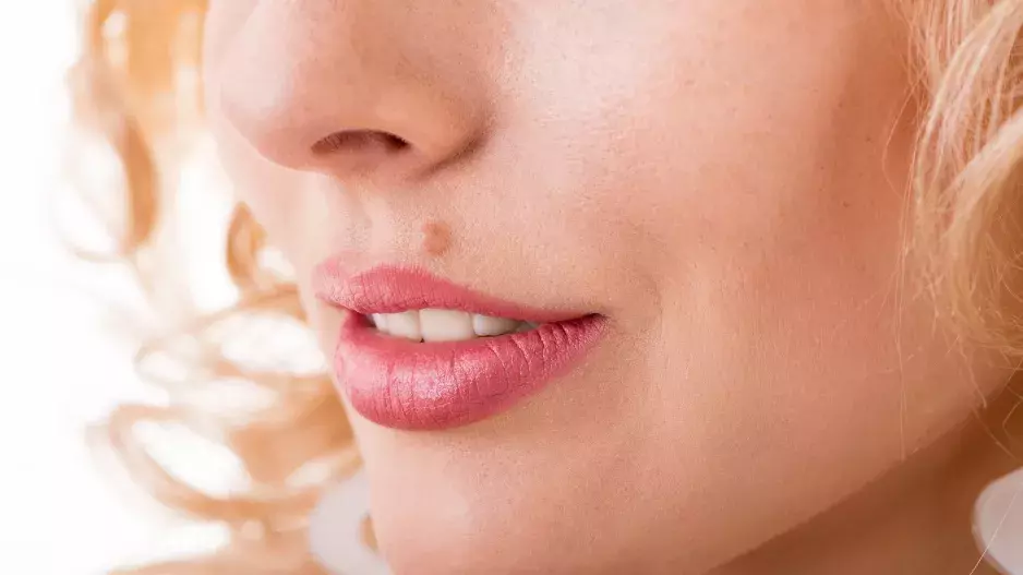 Mateřská znaménka v obličeji: Co vypovídá jejich umístění o povaze a osobnosti člověka