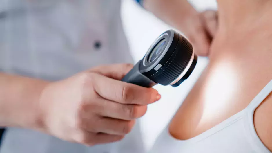 Rakovina kůže: Nemoc pomůže odhalit včas jeden opomíjený příznak. Světlá pleť je nejrizikovější