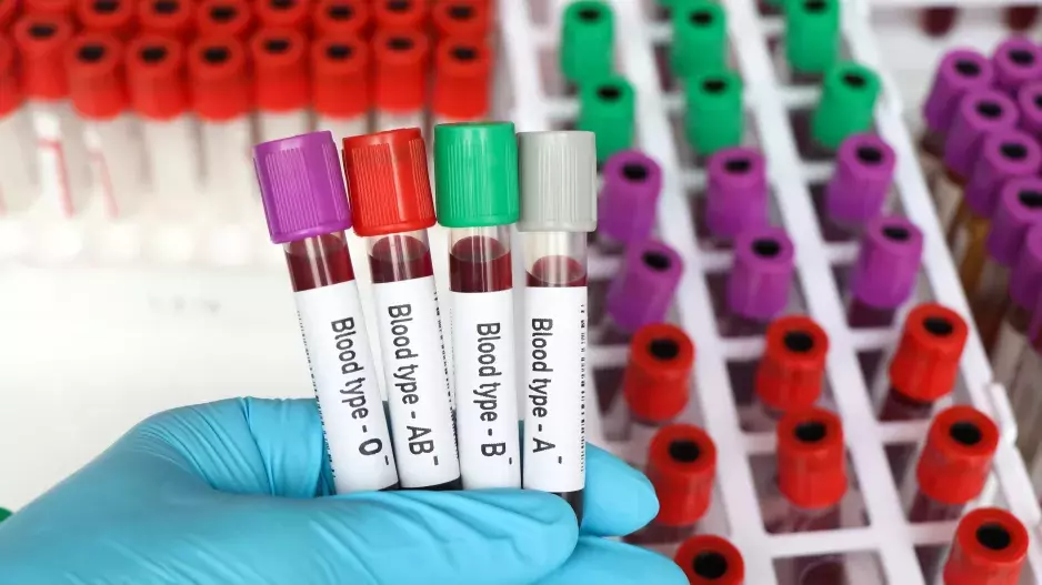 Vědecká studie: Zdraví může ovlivnit i vaše krevní skupina. Zjistěte, k jakým nemocem jste náchylní na základě toho, jakou krevní skupinu máte