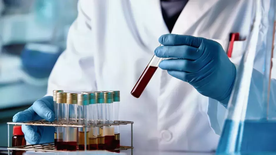 Modřiny, noční pocení nebo únava: Některé příznaky zhoubného onemocnění, které byste neměli podceňovat