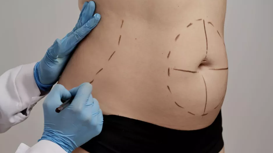 Turecko láká na levné plastické operace. I přes řadu spokojených klientů mohou být nebezpečné, varují odborníci