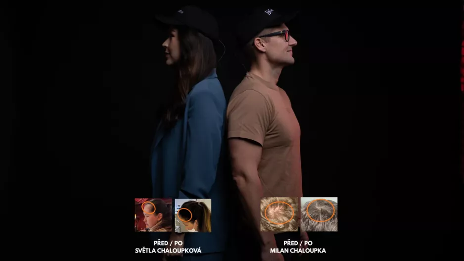 Boostetix - česká inovace v péči o vlasy. Boostetix Prime vědecky ověřená technologie proti vypadávání vlasů