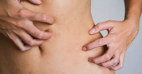 Trápí vás zarudlá a vysušená pokožka? Dopřejte si správnou péči