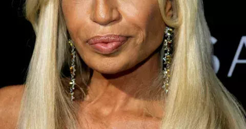 Jak by celebrity vypadaly bez plastik: Grafik si s touto myšlenkou pohrál a změnil slavné k nepoznání