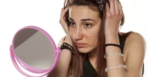 Poradna: Kvůli silnému akné jsem se bála vyjít z domu. Takto mi zničilo sebevědomí i život (Lucka 27)