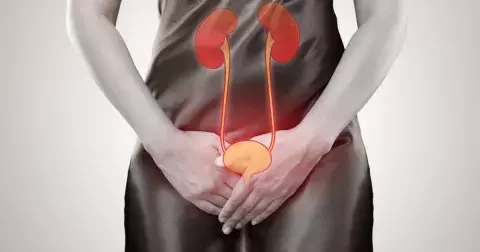 Pozor na zánět močových cest, který umí potrápit hlavně v létě! Jak předejít vleklému trápení?