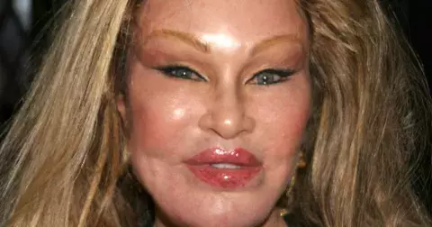 Kočičí žena: Kdysi bývala neskutečně bohatá a krásná. Dnes pobírá sociální dávky a obličej má znetvořený plastikami