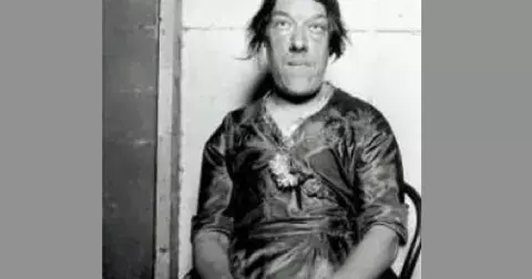 Nejošklivější žena na světě: Nechala se šikanovat proto, aby uživila své děti