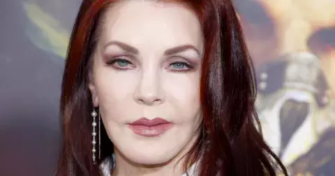 Plastiky celebrit, které se opravdu nepovedly: Břicho Tary Reid, omlazení Priscilly Presley a další zpackané zákroky